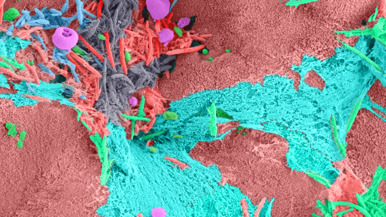 Scanning electron microscopy (SEM) image of bacteria in the mouse colon