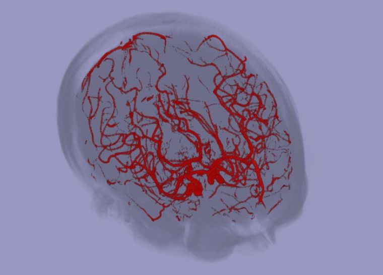 Stylistic image of brain with blood vessels outlined