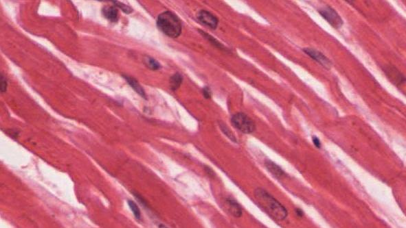 Photomicroph of cardiac muscle tissue