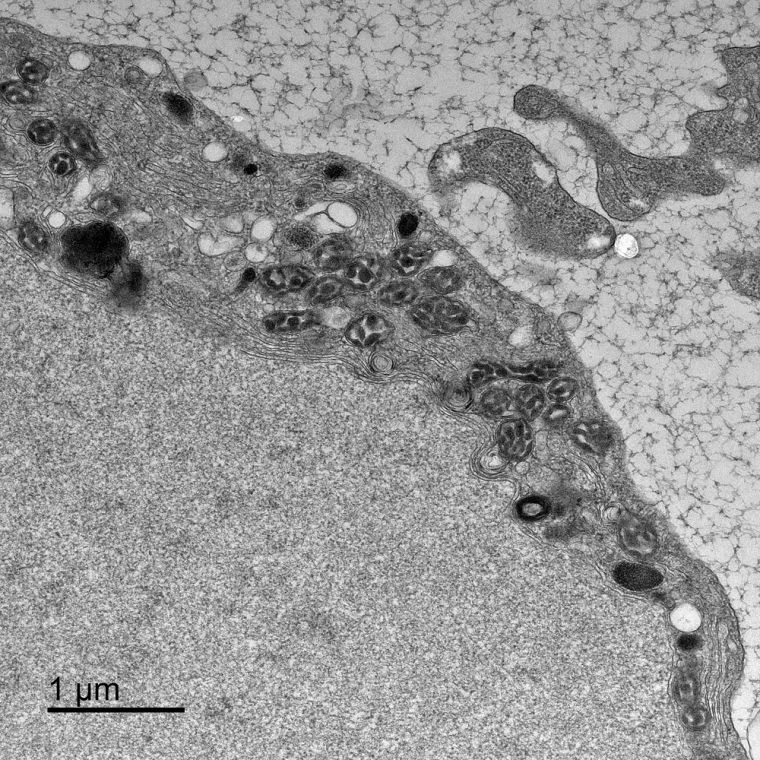 Black and white electron microscopy image showing a slice through a cell. Deformed mitochondria are visible.