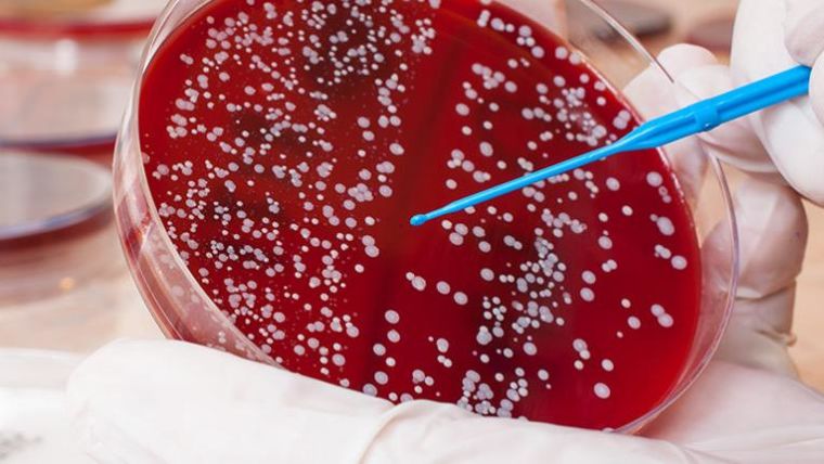 Blood red petri-dish in the hand of a researcher with bacterial colonies grown on the plate.